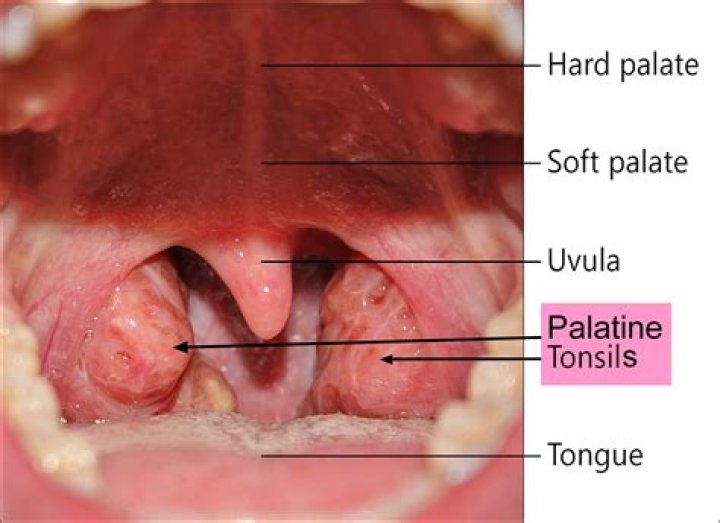 Are your tonsils located?