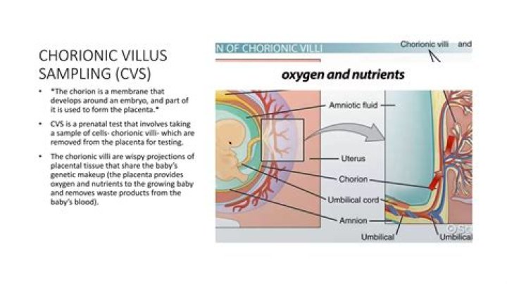 Can chorionic villus sampling tell gender?