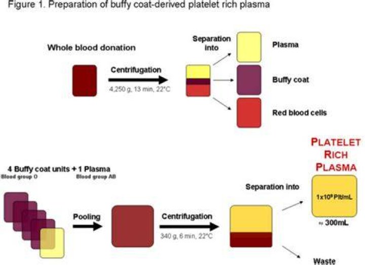 Can platelet be separated from blood?