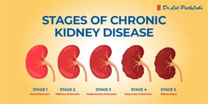 Can qsymia cause kidney problems?