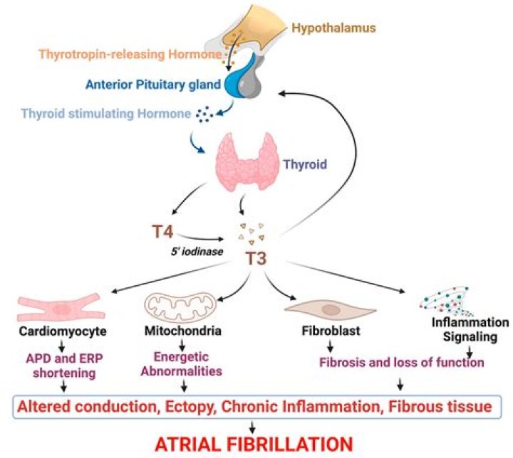 Can thyroxine cause high blood pressure?