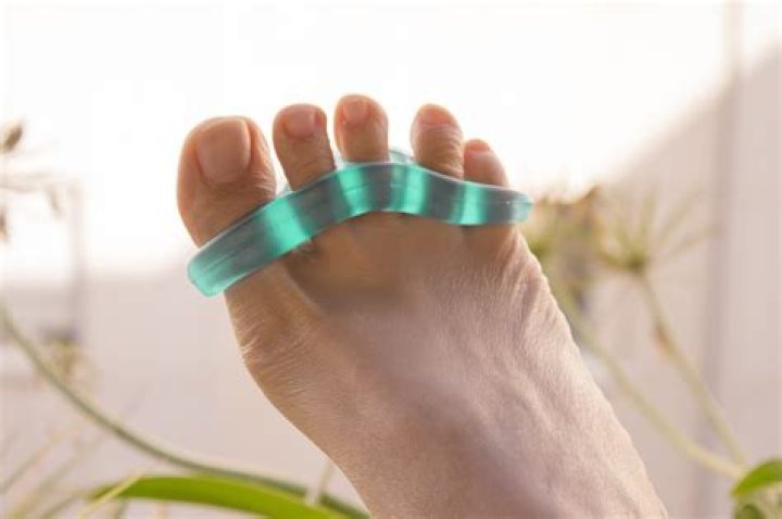 Can toe separators cause pain?