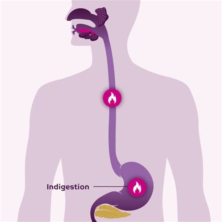 Does indigestion cause constipation?