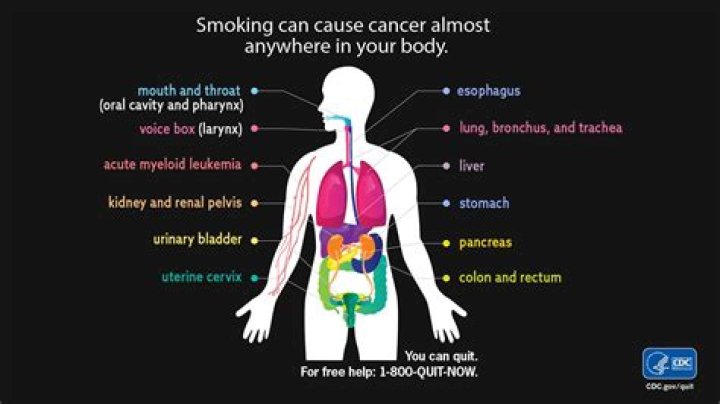 Does smoking cause blebs?