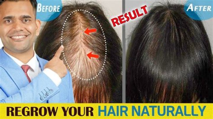Is fallen hair regrow?