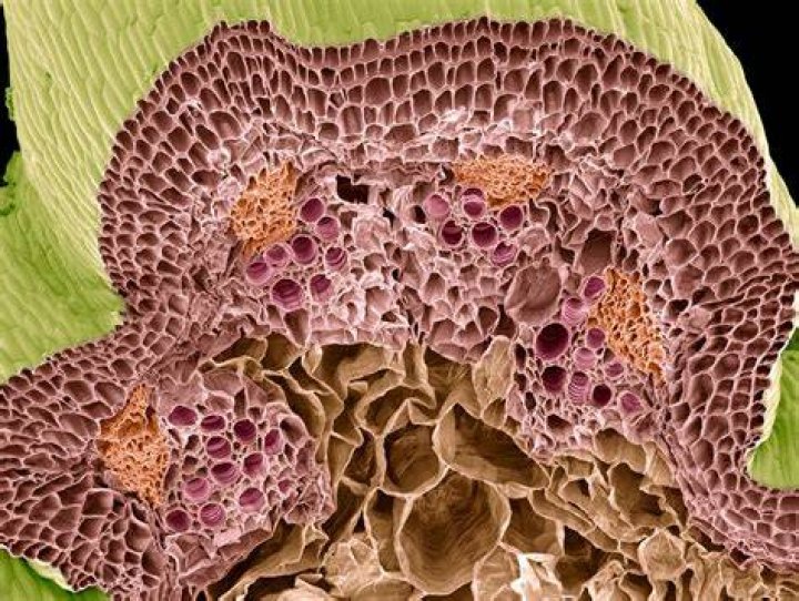 What are tyloses in botany?