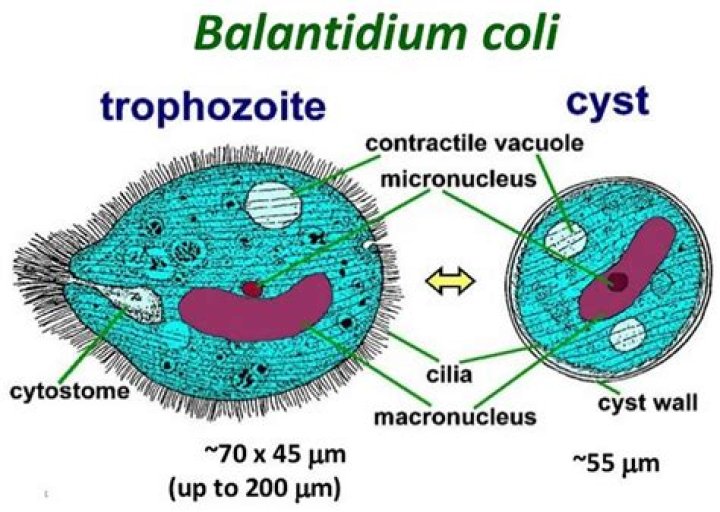 What disease does balantidium coli cause?