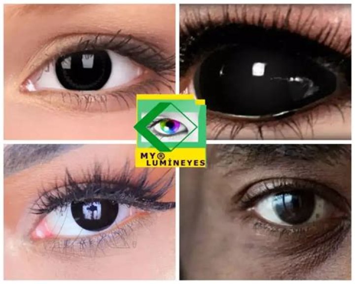 What do black colored eyes mean?