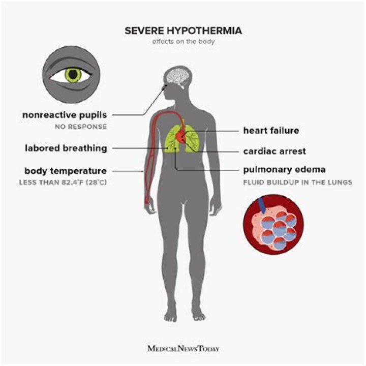 What does hypothermia indicate?