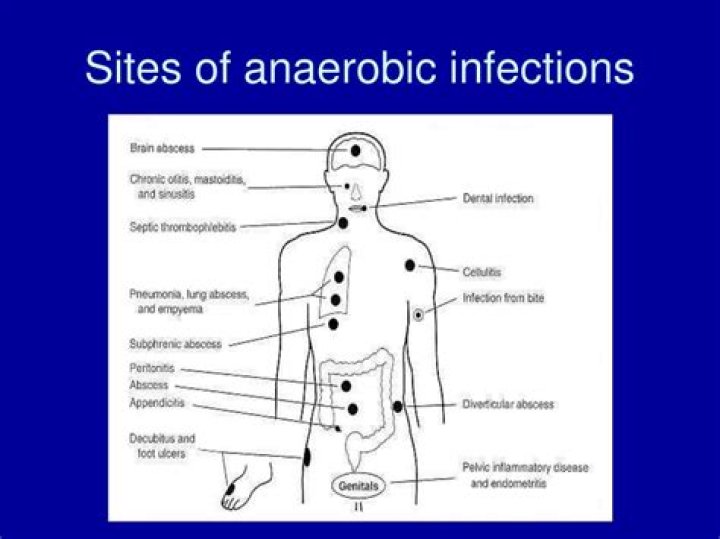 Where are anaerobes found?