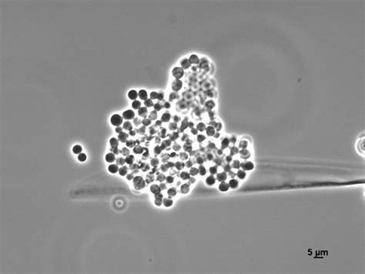 Where is mucor racemosus found?