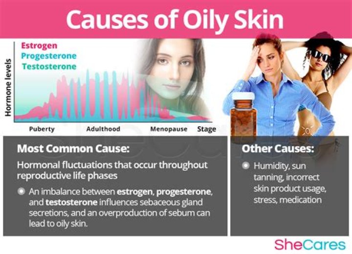 Which hormone causes oily skin?