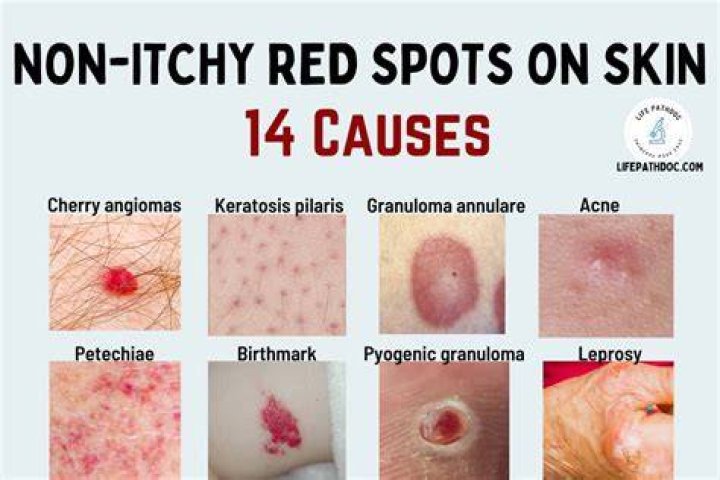 Why do i have under skin spots?