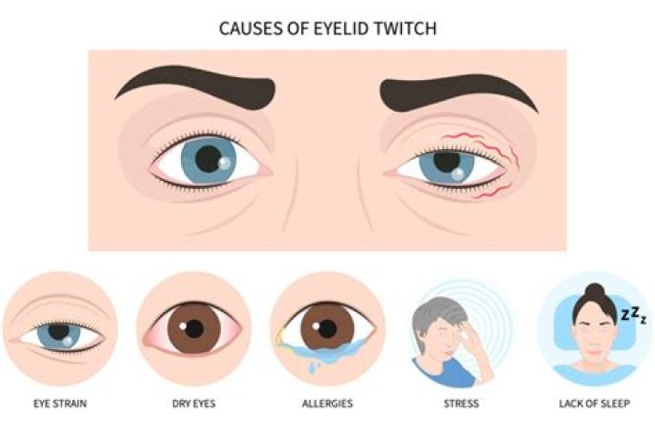 Why is my left eye winking?