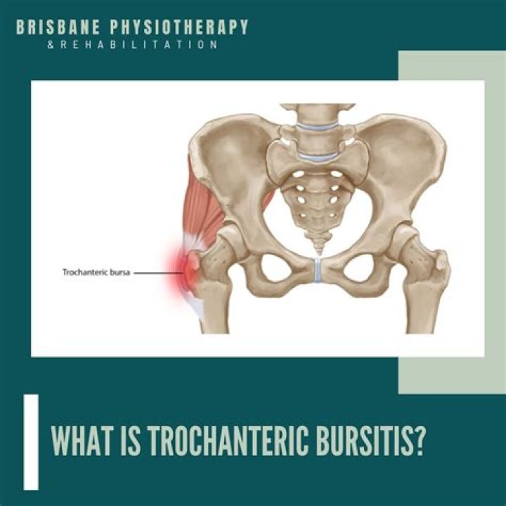 Why is trochanteric bursitis so painful?
