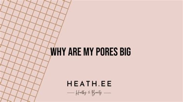 Why my pores are big?
