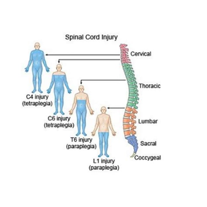 Why spinal cord pain occurs?
